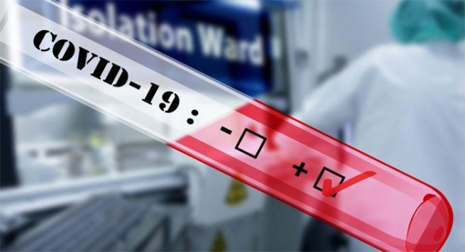 Coronvirus, è aumentata di oltre 100 volte la carica virale nei tamponi