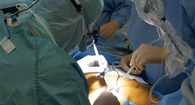 Ospedale Cardarelli, trapianto di fegato in tempo di pandemia: restituita la vita ad un 45enne