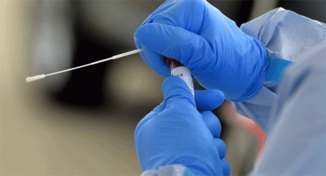 Castellammare - Coronavirus, 31 nuovi casi e 3 guarigioni