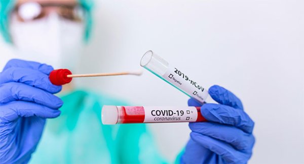 Torre Annunziata - Coronavirus, torna a salire il numero dei contagi: 215 nelle ultime 24 ore